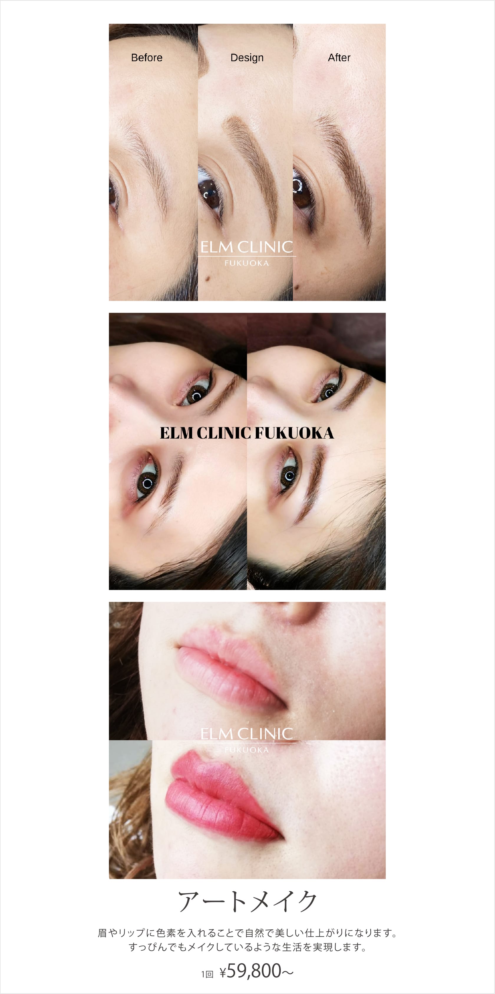 美容皮膚科エルムクリニック 福岡院