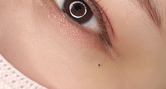 アートメイク『ほくろ』の説明画像